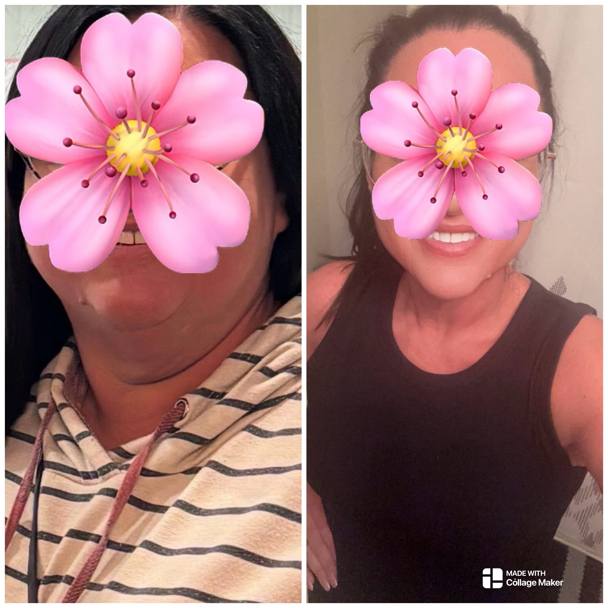 Two images of a person with a pink flower covering their eyes, one on a striped shirt and one on a black tank top.